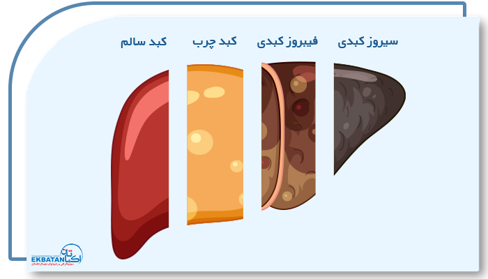 فیبرواسکن دو